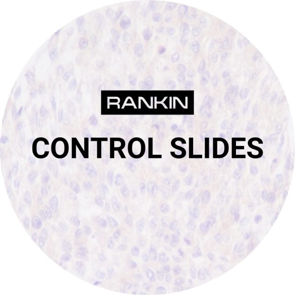 Control Slides, Varicella TBS Sale