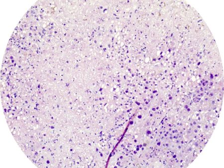 Control Slides, IHC - Adenovirus Supply